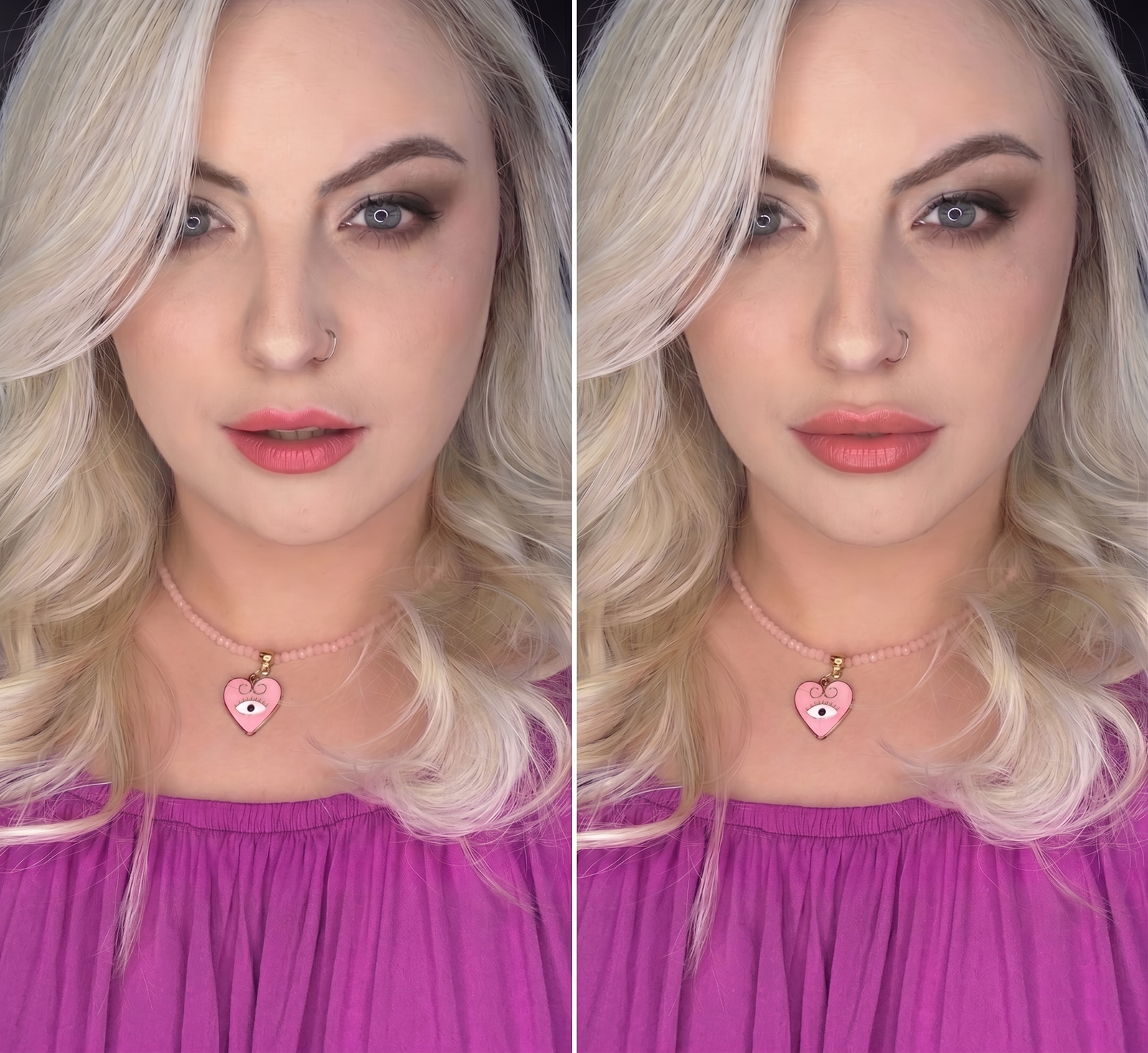 Harmonização Facial